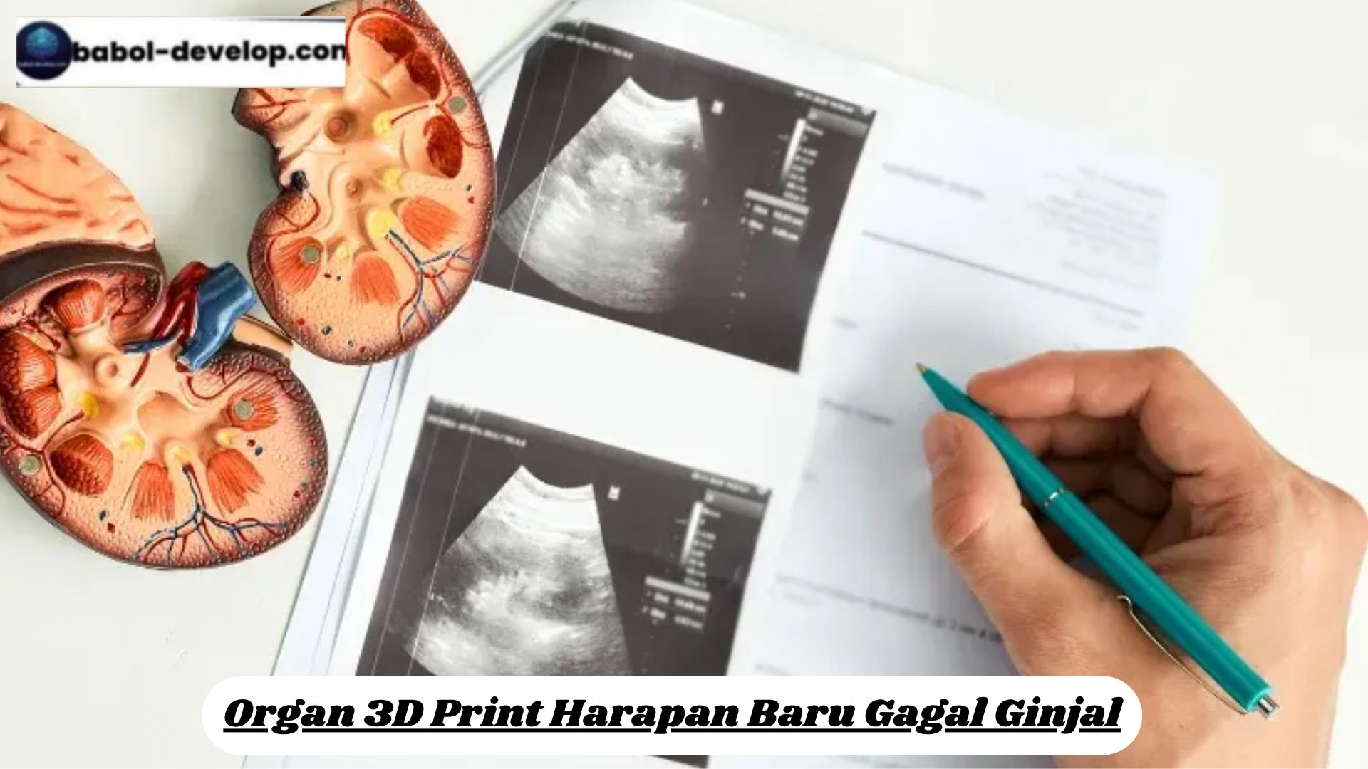 Organ 3D Print Harapan Baru Gagal Ginjal